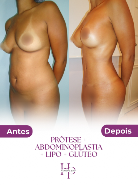 Captura de tela 2025-11-25 180822