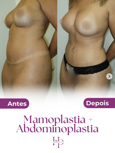 Captura de tela 2025-11-25 180844