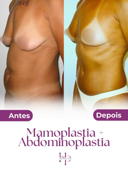 Captura de tela 2025-11-25 180852